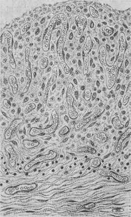 ��ѿ��֯���½ṹģʽͼ