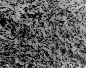 �ѳ���Ĥϸ��<a href=