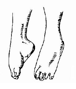 ���㴤���ľ���