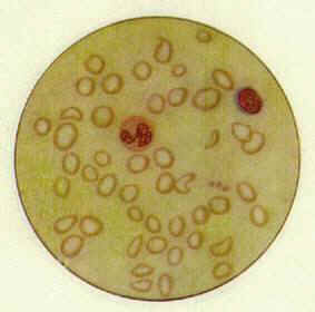 ��ϸ����С����