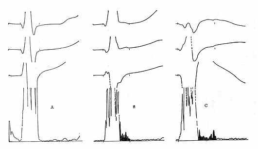 �������쳣���źŵ����ĵ�ͼ
