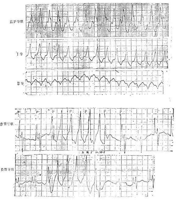 ʳ�ܵ����ĵ�ͼ���١���ʾ�ķ�����Ⱥ��P��