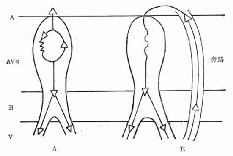 ���ҽ��ڼ����Ҽ��۷��������ٵ�ʾ��ͼ