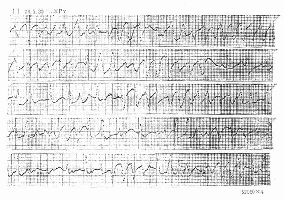 ���Ťת�������Ķ�����