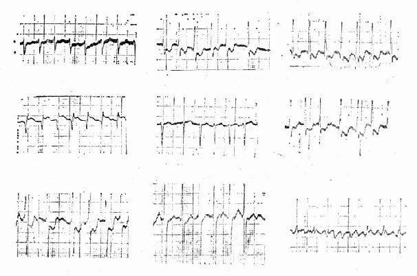 �ķ��˲��ĵ�ͼ