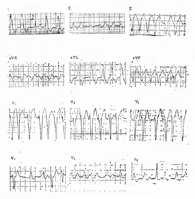Ԥ���ۺ����ϲ��ķ�����