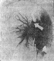 ��˨�������ּ�ӰѪ����Ӱ