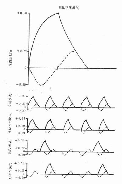 ����ͨ��ģʽ�ĵ�������ѹ������