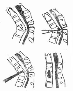 ǰ·��ѹ��ֲ���ں���