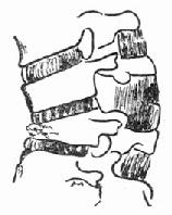 ǰ��ѹ������