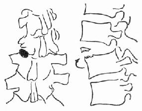 ������ת����