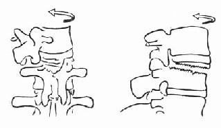 ��ת��������