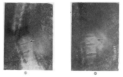 ����������������ý��