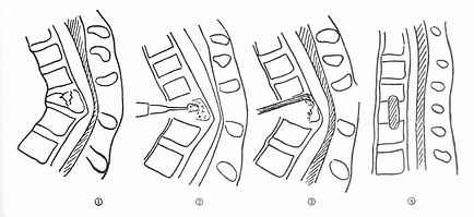 ǰ·����������ת�ͼ�������