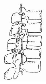 ׵���Chance���۵�����