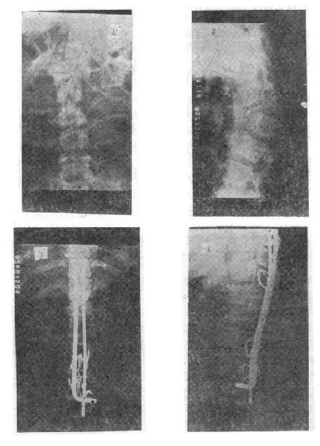 ��Ƭ���۵�����