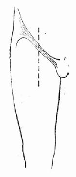 ��֫����ȡ˨�ڹɲ��������п�