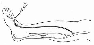 ���㱳����ȡ˨