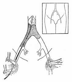 �����������˨�����ҹ��ܶ���ȡ˨