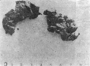 �ķ�����Ѫ˨ͼ