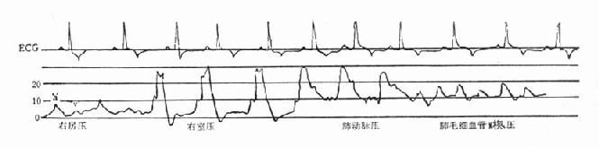 Ư�����ܲ���Ҳ��ķ������ҡ��ζ�������ëϸѪ��Шѹ