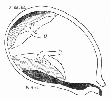 ̥�����ڰ���