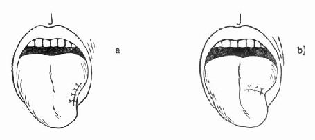 �����˵Ĵ���