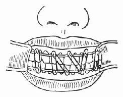 ���ǹ�����ǣ����λ�̶�