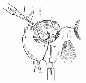 ȧ�ǹ����п���λ�Ǽ�̶�