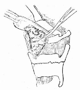 �г��������Ѫ��