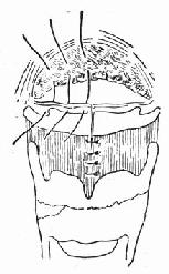 ��������������Ĥ������Ĥ