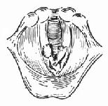 ����ճĤ����