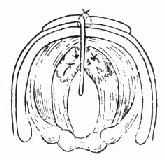 ��״���ǰ�������Ƭ