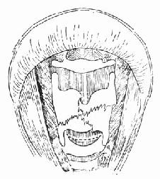 ���ѿ���