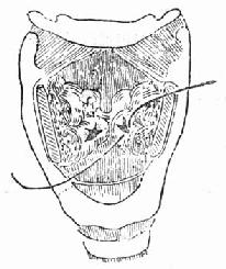 ֱ���·�Ϻ�ճĤ�ѿ�