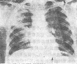 �ҷλ�ŧ�Է���֮X�߱���