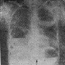 �����ѷ���֮X�߱���