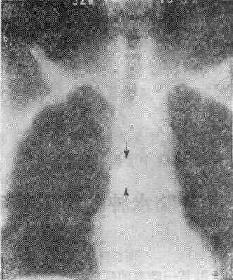 ������<a href=