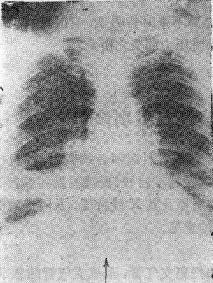 ���·β���