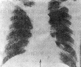 ֧����ճҺ˨����β���