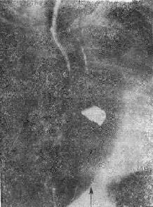 �����֧���ܶ���