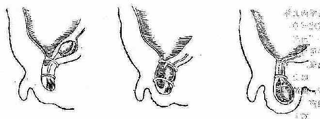 غ���½�����