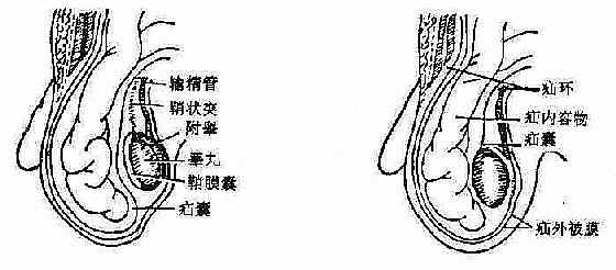 ���ɹ�б�޽ṹ�ص�