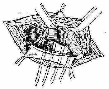 ������ϼ����븹�ɹ��ʹ�