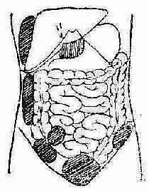 ��ǻŧ�׺÷���λ