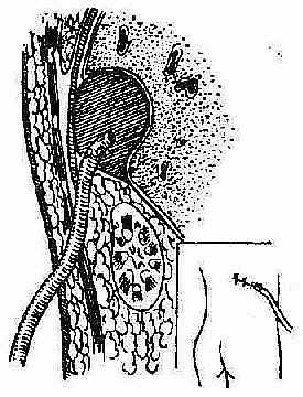 ����ŧ�׾�����������