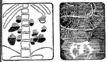 ���Գ�����X����ʾ��ͼ