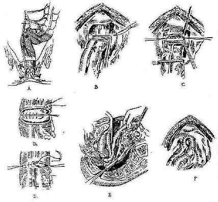 ֱ��ǰ�г�����Dixon������