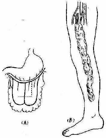 ������Ĥ��ֲ��