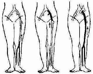 ��֫���Ѫ˨�γɵ�����